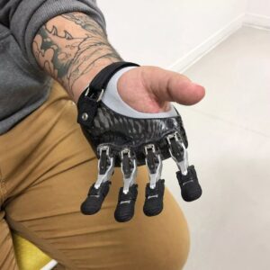 11/11/25 Prosthetics and the Role of OT